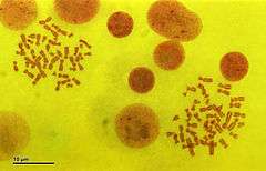 Can a quirky chromosome create a second human species?